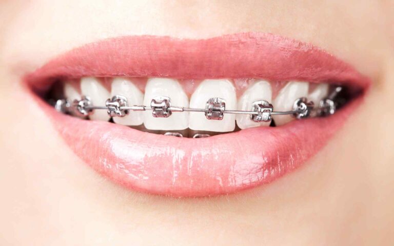 https://dianelladental.com.au/wp-content/uploads/2020/01/post_05-768x480.jpg